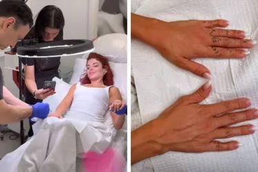 Imagem ilustrativa da imagem Gkay faz harmonização das mãos com médico das celebridades em Los Angeles