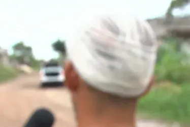 Imagem ilustrativa da imagem Homem tenta separar briga em bar e é esfaqueado na cabeça por amigo em Vila Velha