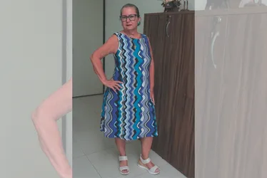 Imagem ilustrativa da imagem Lipedema: entenda doença que afeta 211 mil mulheres no ES