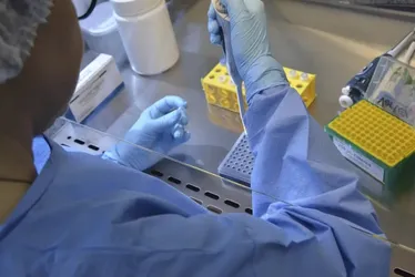 Imagem ilustrativa da imagem Médicos do ES analisam a primeira vacina contra Chikungunya aprovada pela Anvisa