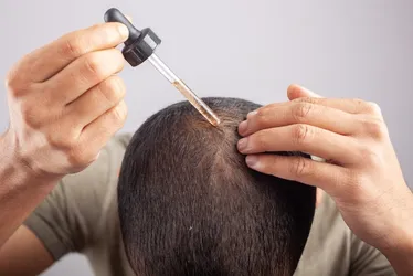 Imagem ilustrativa da imagem Minoxidil pode causar crescimento anormal de pelos em bebês, alerta Anvisa