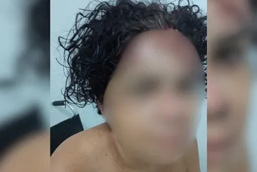 Imagem ilustrativa da imagem Mulher é agredida com pedrada e ex-namorado é principal suspeito