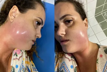 Imagem ilustrativa da imagem Mulher morre por infecção generalizada após tratamento dentário