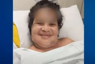 Imagem ilustrativa da imagem Mulher perde parte da orelha após ser agredida pelo ex-companheiro