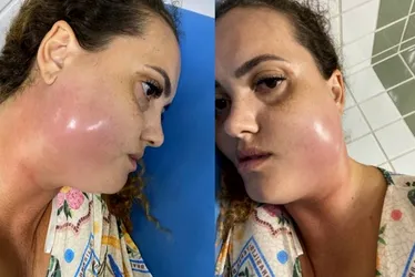 Imagem ilustrativa da imagem Conselho vai investigar caso de mulher que morreu após procedimento dentário