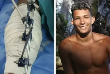 Imagem ilustrativa da imagem “Qual a dúvida de quem é a vítima?”, diz mãe de ambulante baleado por delegado