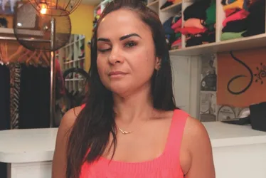 Imagem ilustrativa da imagem Uso estético do botox não é inofensivo à saúde, diz estudo