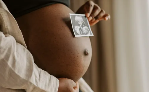 
          Imagem ilustrativa da imagem Brasil tem em 2023 o menor número de nascimentos em quase 50 anos
          