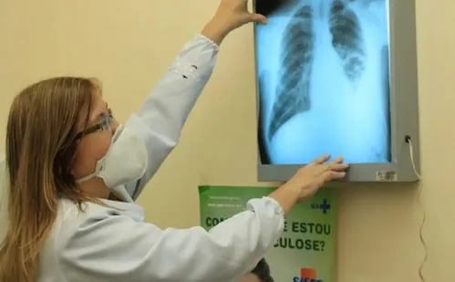 
          Imagem ilustrativa da imagem Baixo financiamento mundial ameaça combate à tuberculose
          