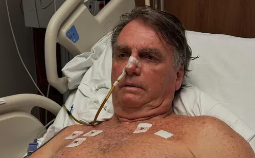 
          Imagem ilustrativa da imagem Bolsonaro dá entrevista do hospital e volta a criticar ação sobre golpe de Estado
          