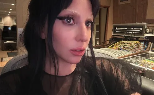 
          Imagem ilustrativa da imagem Entenda as doenças que fizeram Lady Gaga cancelar show no Brasil em 2017
          