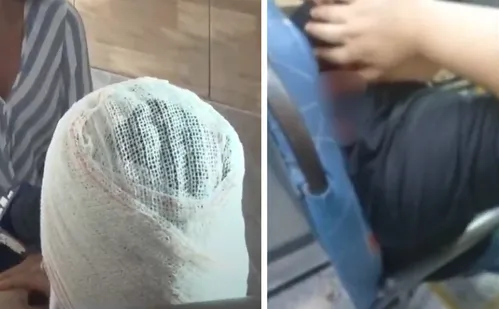 
          Imagem ilustrativa da imagem "Muita covardia", diz passageira baleada na nuca durante assalto a ônibus na Serra
          