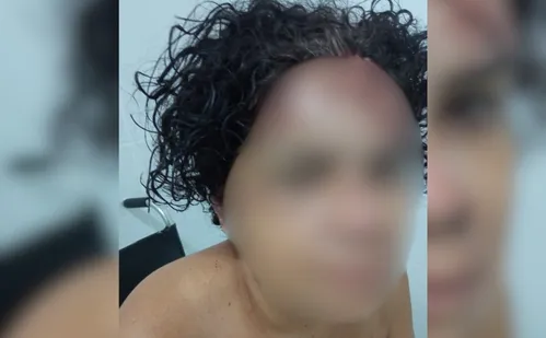 
          Imagem ilustrativa da imagem Mulher é agredida com pedrada e ex-namorado é principal suspeito
          