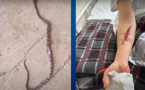 
          Imagem ilustrativa da imagem Mulher é hospitalizada após ser picada por jararaca em Domingos Martins
          