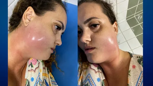 
          Imagem ilustrativa da imagem Mulher morre por infecção generalizada após tratamento dentário
          