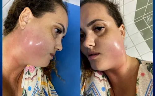 
          Imagem ilustrativa da imagem Mulher que morreu após tratamento dentário foi à UPA quatro vezes
          