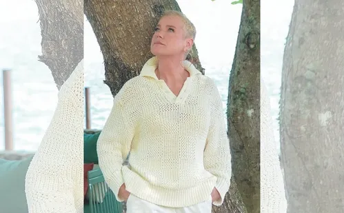 
          Imagem ilustrativa da imagem Mulheres buscam cirurgias para se livrar da calvície
          