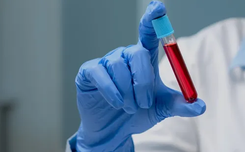 
          Imagem ilustrativa da imagem Professor que usou mesma agulha em 44 alunos no ES é demitido
          