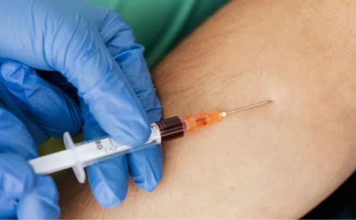 
          Imagem ilustrativa da imagem Professor que usou mesma agulha em 44 alunos no ES diz que tomou todos os cuidados
          