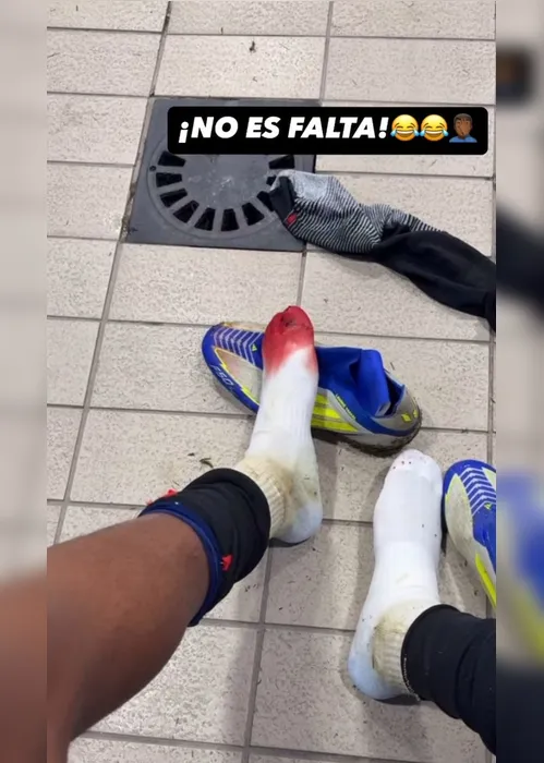 Imagem ilustrativa da imagem Estrela do Barcelona mostra pé ensanguentado de entrada dura de rival que nem falta foi; veja