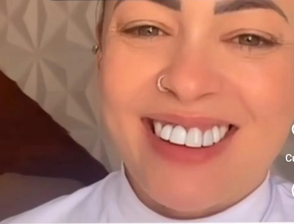 Imagem ilustrativa da imagem Cantora denuncia clínica odontológica por serviço mal feito e resultado desastroso