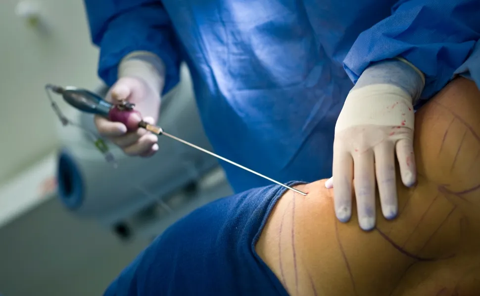 Imagem ilustrativa da imagem Cirurgias plásticas no Espírito Santo atraem pacientes até dos EUA