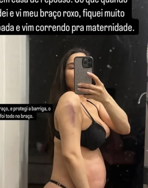 Imagem ilustrativa da imagem Grávida, Raissa Barbosa vai parar no hospital após cair de escada