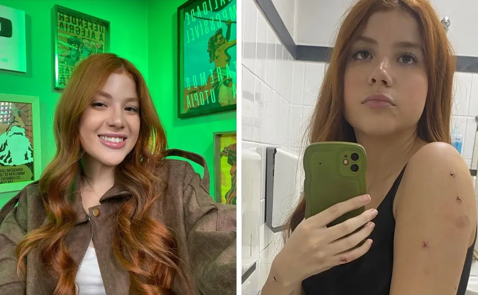 Imagem ilustrativa da imagem Influenciadora diz ter sido vítima de facadas dadas pelo irmão, preso em flagrante