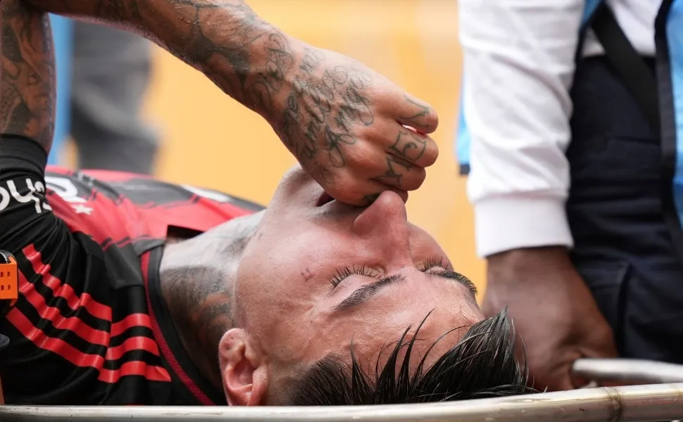 Imagem ilustrativa da imagem Pulgar sofre fratura no pé e deve desfalcar Flamengo por até 3 meses