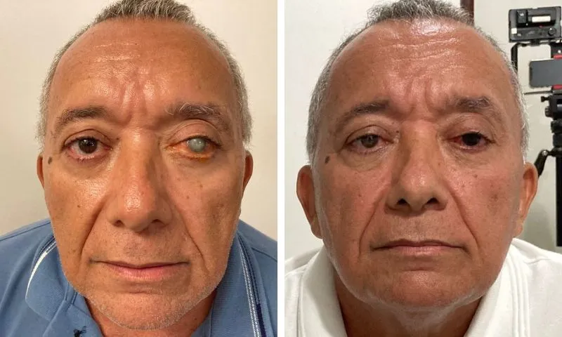 Imagem ilustrativa da imagem Tatuagem ocular acende alerta em olhos saudáveis, mas resgata autoestima de cegos