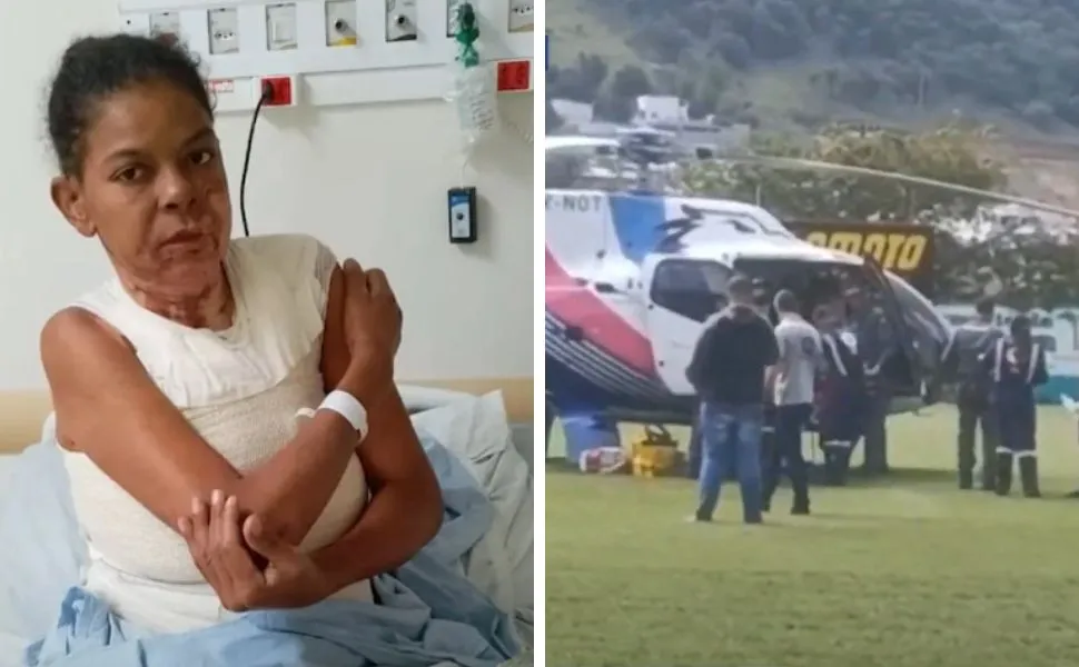 Imagem ilustrativa da imagem Mulher é internada na Serra após ter 15% do corpo queimado pelo companheiro