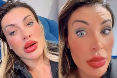 Imagem ilustrativa da imagem Andressa Urach desabafa após mudar cor dos olhos: 'espero não ficar cega'
