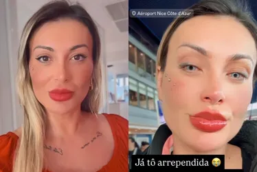Imagem ilustrativa da imagem Andressa Urach muda cor dos olhos com cirurgia e se arrepende: 'orem por mim'