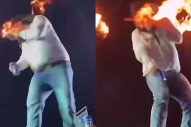 Imagem ilustrativa da imagem Cantor sertanejo fica ferido após ser atingido por fogo durante show