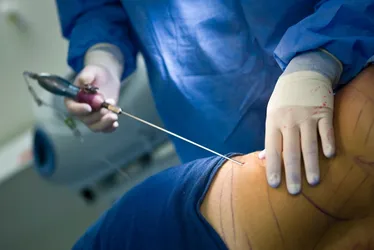 Imagem ilustrativa da imagem Cirurgias plásticas no Espírito Santo atraem pacientes até dos EUA