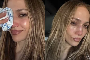 Imagem ilustrativa da imagem Jennifer Lopez sofre acidente em ensaio de premiação e leva pontos no rosto