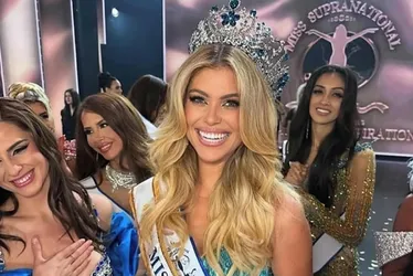 Imagem ilustrativa da imagem Jovem do Estado é eleita a mais bonita do mundo em concurso de beleza