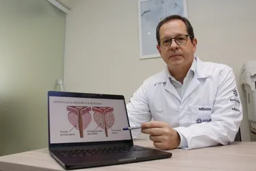 Imagem ilustrativa da imagem Maioria dos homens vai ter aumento da próstata, afirma urologista