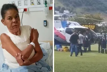 Imagem ilustrativa da imagem Mulher é internada na Serra após ter 15% do corpo queimado pelo companheiro
