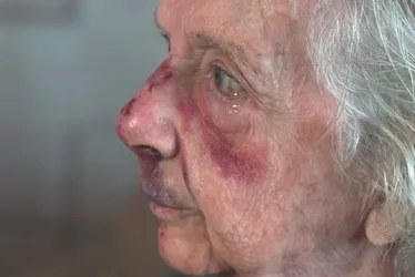 Imagem ilustrativa da imagem “Não vou deixar de sair”, diz idosa ferida em roubo no Centro de Vitória