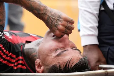 Imagem ilustrativa da imagem Pulgar sofre fratura no pé e deve desfalcar Flamengo por até 3 meses