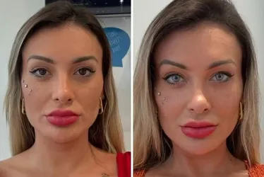 Imagem ilustrativa da imagem Tatuagem ocular acende alerta em olhos saudáveis, mas resgata autoestima de cegos