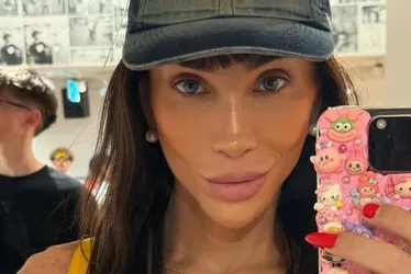 Imagem ilustrativa da imagem Riscos no procedimento para mudar a cor dos olhos, como fez Andressa Urach