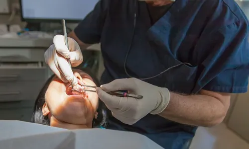 
          Imagem ilustrativa da imagem Ação gratuita no dia 27 de maio leva orientações sobre câncer de boca à população
          