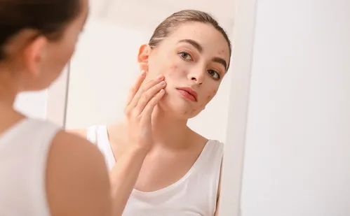 
          Imagem ilustrativa da imagem Alunos inseguros na escola por conta da aparência, diz pesquisa
          