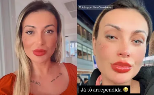 
          Imagem ilustrativa da imagem Andressa Urach muda cor dos olhos com cirurgia e se arrepende: 'orem por mim'
          