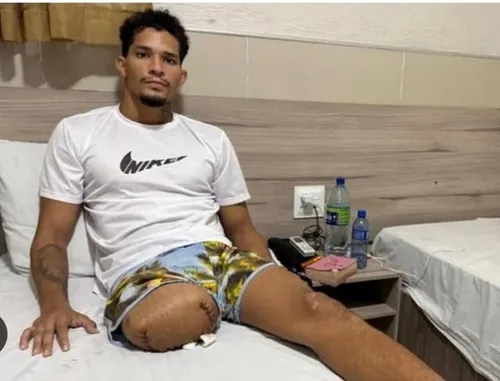 
          Imagem ilustrativa da imagem Delegado que atirou em rapaz em Noronha é indiciado por lesão corporal gravíssima
          