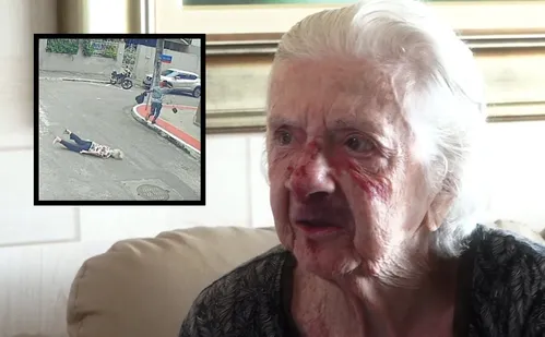 
          Imagem ilustrativa da imagem Idosa agredida em assalto foi abordada por homem momentos antes: 'pediu dinheiro'
          