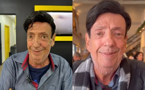 
          Imagem ilustrativa da imagem Marcos Oliveira, o Beiçola, coloca prótese capilar e mostra o resultado
          