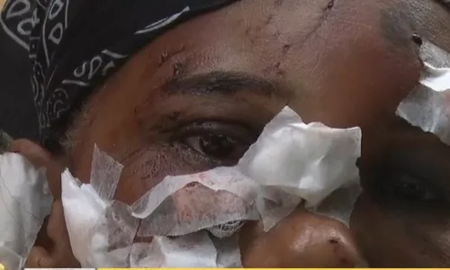 
          Imagem ilustrativa da imagem Com distúrbios mentais, marido tenta matar esposa e é preso pelado no meio da rua
          